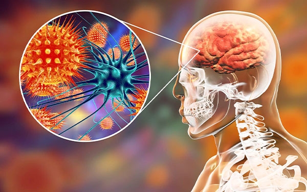 Meningitis, enfermedad que puede ser mortal en 24 horas