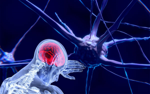 Cerca de 2,5 millones de personas viven con Esclerosis M&uacute;ltiple