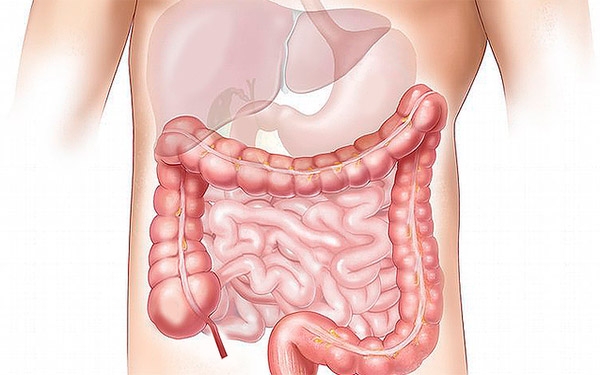 El intestino, hogar de bacterias y virus en perfecta armon&iacute;a, &iquest;c&oacute;mo sucede?