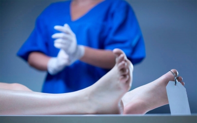 Estudio revela que el cuerpo humano se mueve a&uacute;n tras la muerte