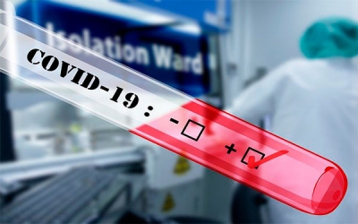 Cuatro avances de la ciencia frente a la urgencia del coronavirus
